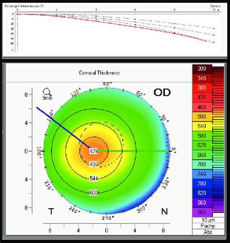 corneal thickness is measured by|average corneal thickness range.